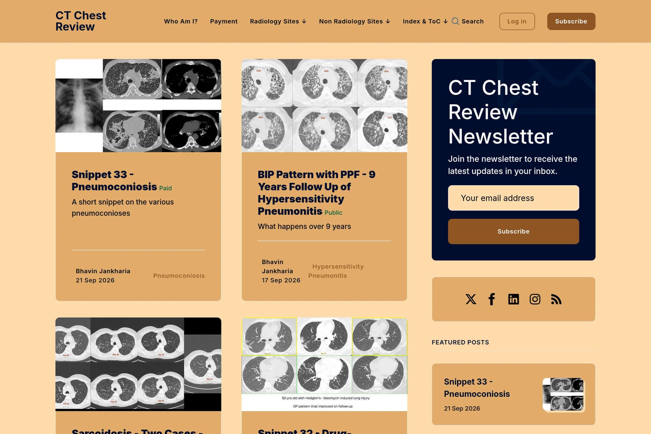 Screenshot of CT Chest Review — Ghost theme website